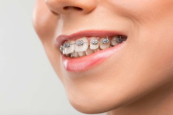 Orthodontist in Haldwani